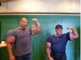 Synthol Side Effect Pictures