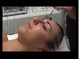 Aqua Facial Treatment Pictures