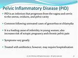 Pictures of Pelvic Inflammatory Disease Treatment Antibiotics