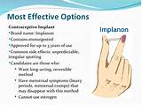 Side Effects On Birth Control Implant Images