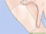 How To Hide Scars On Legs Without Makeup Photos
