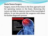 Images of Best Place For Brain Cancer Treatment