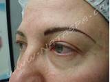 Pictures of Permanent Makeup Toronto