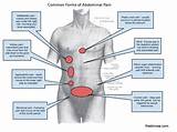 Lower Abdominal Pain And Gas Photos