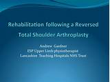 Images of Shoulder Reverse Arthroplasty Rehabilitation