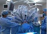 Prostate Removal Robotic Surgery Recovery
