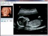 Ultrasound Software Pictures