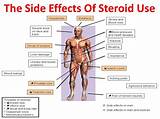 Steroid Injection For Asthma Side Effects Photos