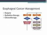 Photos of Chemotherapy And Radiation Therapy For Esophageal Cancer