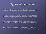 Acute Myeloid Leukemia Life Expectancy Without Treatment Pictures