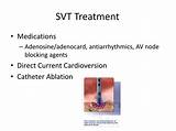 Medications For Svt Heart Photos