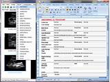 Ultrasound Software Pictures