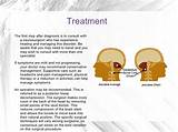 Chiari Malformation Headache Treatment