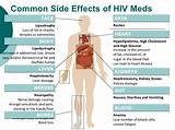 Common Side Effects Of Hiv Medications Pictures