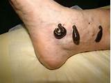 Images of Leeches Medical Benefits