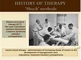 Photos of Shock Therapy History