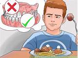 When Can I Chew After Wisdom Teeth E Traction Images