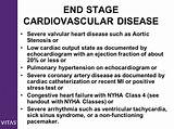 Class 4 Congestive Heart Failure Pictures