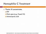 Images of Hemophilia Disease Treatment