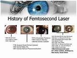 Images of Second Lasik Eye Surgery