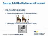 Exercises Before Hip Replacement Photos