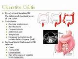 Pictures of Ulcerative Colitis Life Insurance