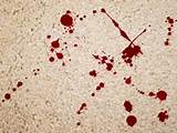 Images of Get Blood Out Of Carpet