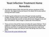 Home Remedies Yeast Infection Mouth Images