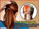 Occipital Muscle Exercises Pictures