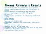 Urinalysis Normal Ranges Images