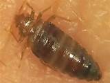 Is There A Natural Way To Kill Bed Bugs Photos