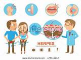 Images of Herpes Doctor