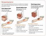 Photos of Electrical Injury Treatment Guidelines