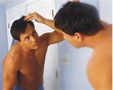 Male Hair Loss Treatment Pictures