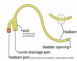 Images of Medical Catheters Types