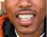 Cheap Gold Grill