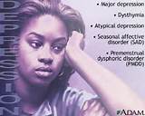 Images of Depression Disorder