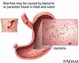 Pictures of Stomach Bug Treatment Adults
