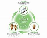 Images of After Lice Treatment Still See Nits