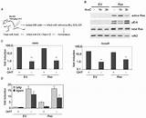 Photos of Acute Myeloid Leukemia Treatment Success Rate