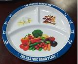 Images of Gastric Band Plate