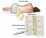 Images of 3 Ways Cancer Can Be Treated