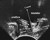 Ultrasound Pelvic Floor Muscles Photos