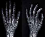 Cleveland Clinic Hand And Wrist Images