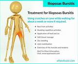 Hip Muscle Strengthening Exercises Bursitis Photos