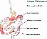 Pictures of What Causes Excessive Gas In The Stomach