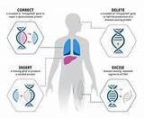 Photos of In Gene Therapy