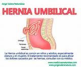 Photos of Home Remedies Umbilical Hernia