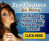 Causes Eye Floaters Mayo Clinic Pictures