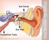 Images of Home Remedies For Hearing Loss Due To Cold